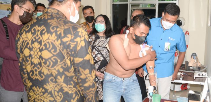BPJS Ketenagakerjaan Jamin Pemasangan Protese Tangan Robotik Pekerja yang Alami Kecelakaan Kerja. (ist)